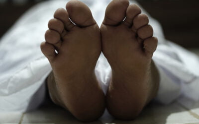 ¿Qué es la tanatopraxia y la tanatoestética?